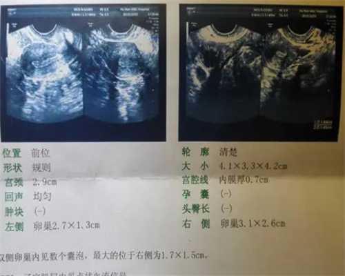 杭州代怀包生女儿,杭州医院做三代试管包生男孩